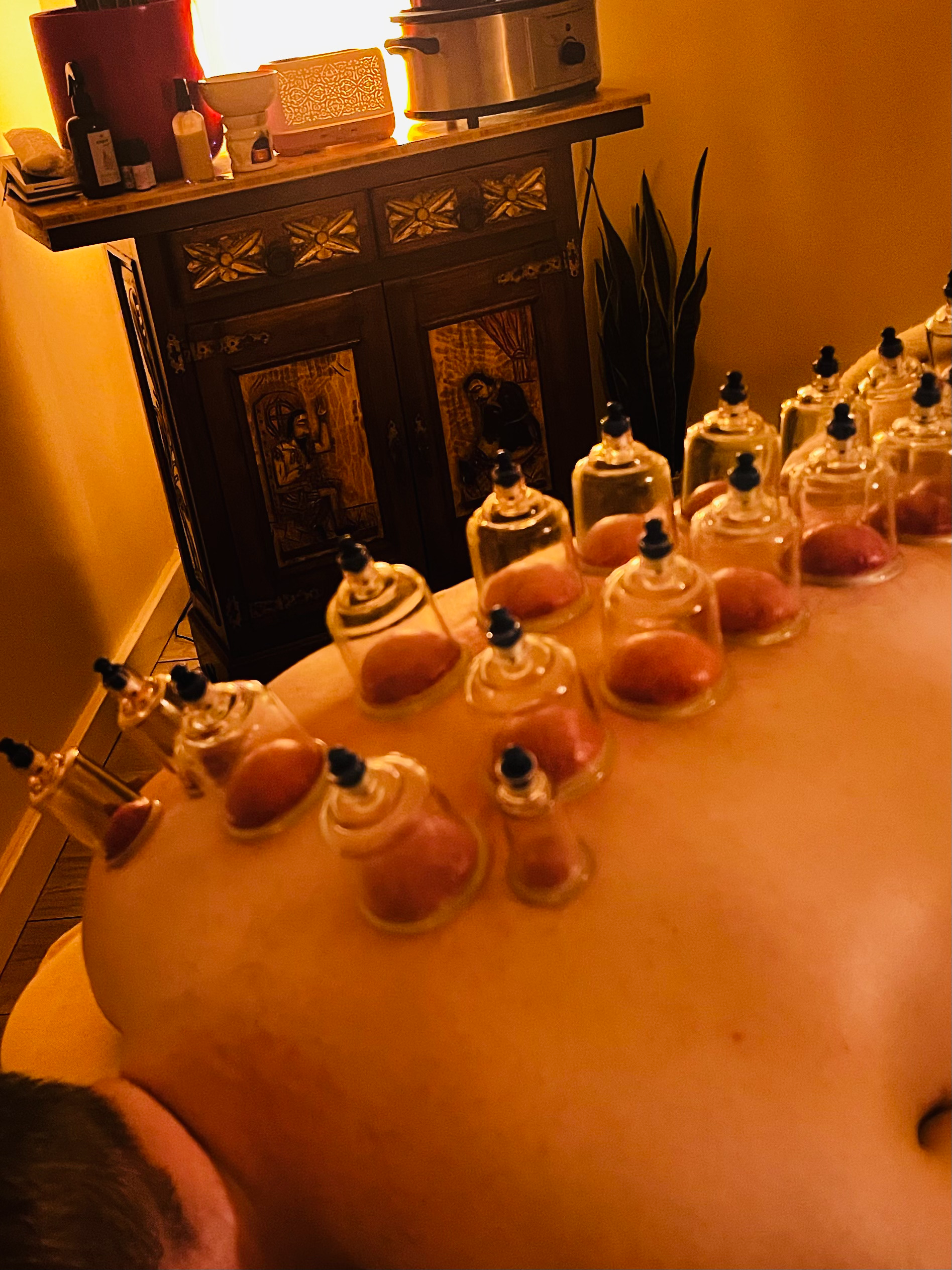 Ventosas Medicina Tradicional China